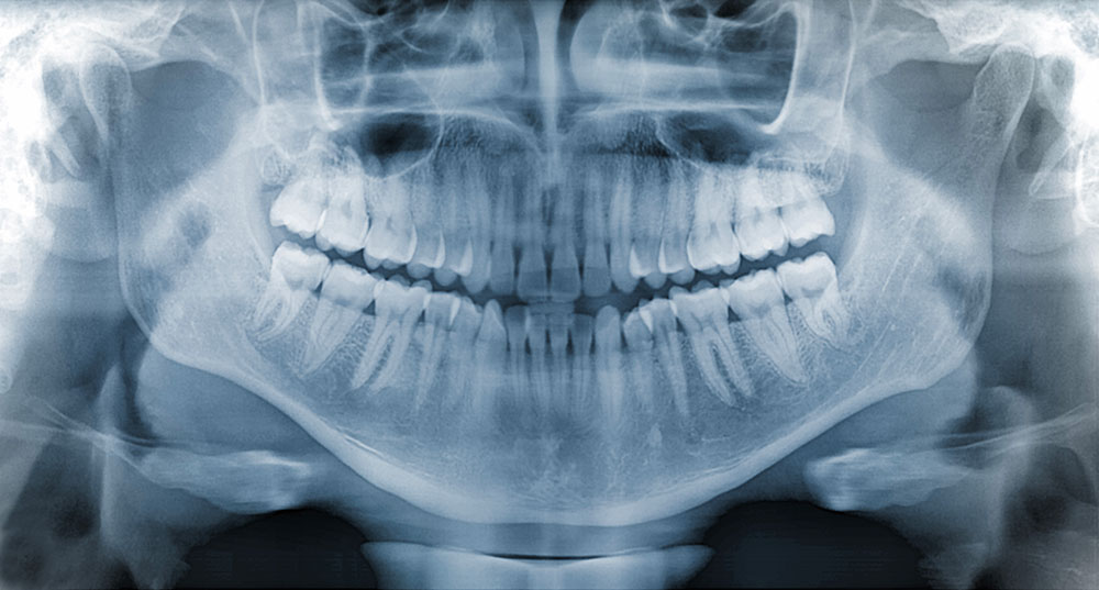 Radiographie dentaire - Cabinet dentaire Dr Ephraim Fareau - Chirurgien dentiste Haguenau - Dentiste Haguenau
